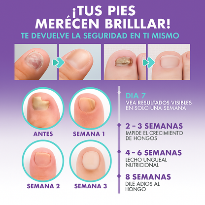 MEDINAIL |TRATAMIENTO PARA UÑAS Y PIES